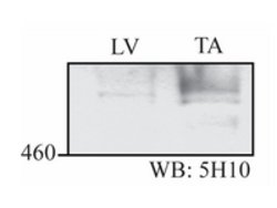 CEP192 Rabbit anti-Human, Polyclonal, MilliporeSigma 200 &mu;L | Buy Online | MilliporeSigma | Fisher Scientific
